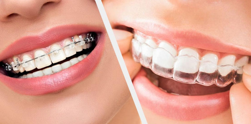 Sensitive Teeth Treatment in Ahmedabad