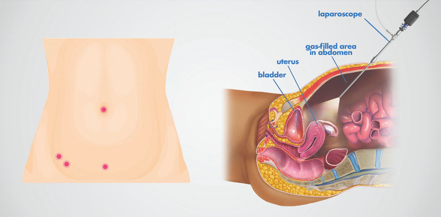 tooth implant treatment in ahmedabad